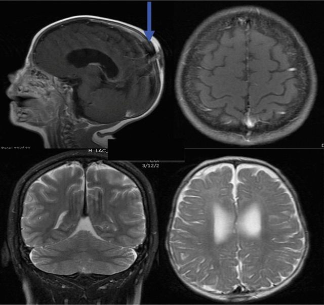 МРТ головного мозга - советы врачей