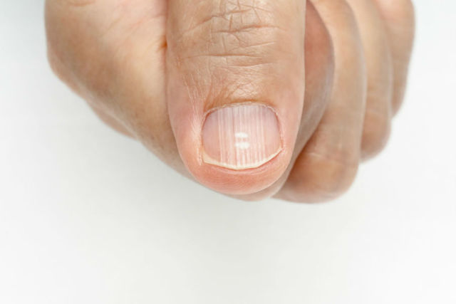 Ногти как зеркало здоровья - советы врачей