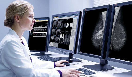 МР-маммография молочных желез - советы врачей