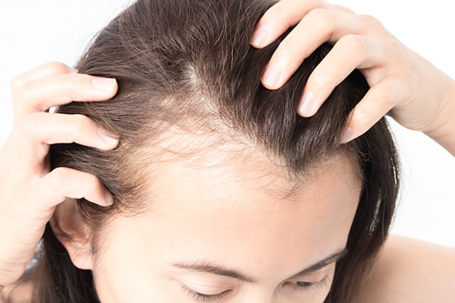 Чрезмерное выпадение волос - советы врачей