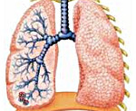 Воспаление лёгких у детей - советы врачей