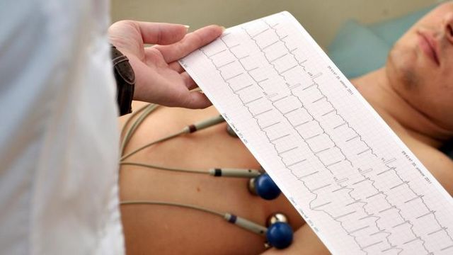 Электрокардиография - советы врачей