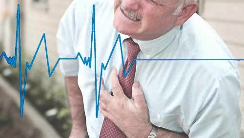 Физическая активность после перенесенного инфаркта миокарда - советы врачей