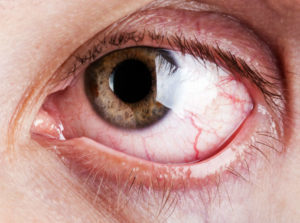 Поражение глаз при сахарном диабете - советы врачей