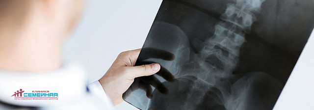 Рентген нижнего отдела позвоночника - советы врачей