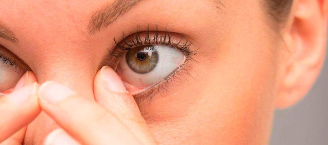 Ячмень глаза - советы врачей