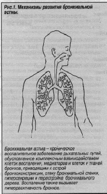 Диагностика и лечение бронхиальной астмы - советы врачей